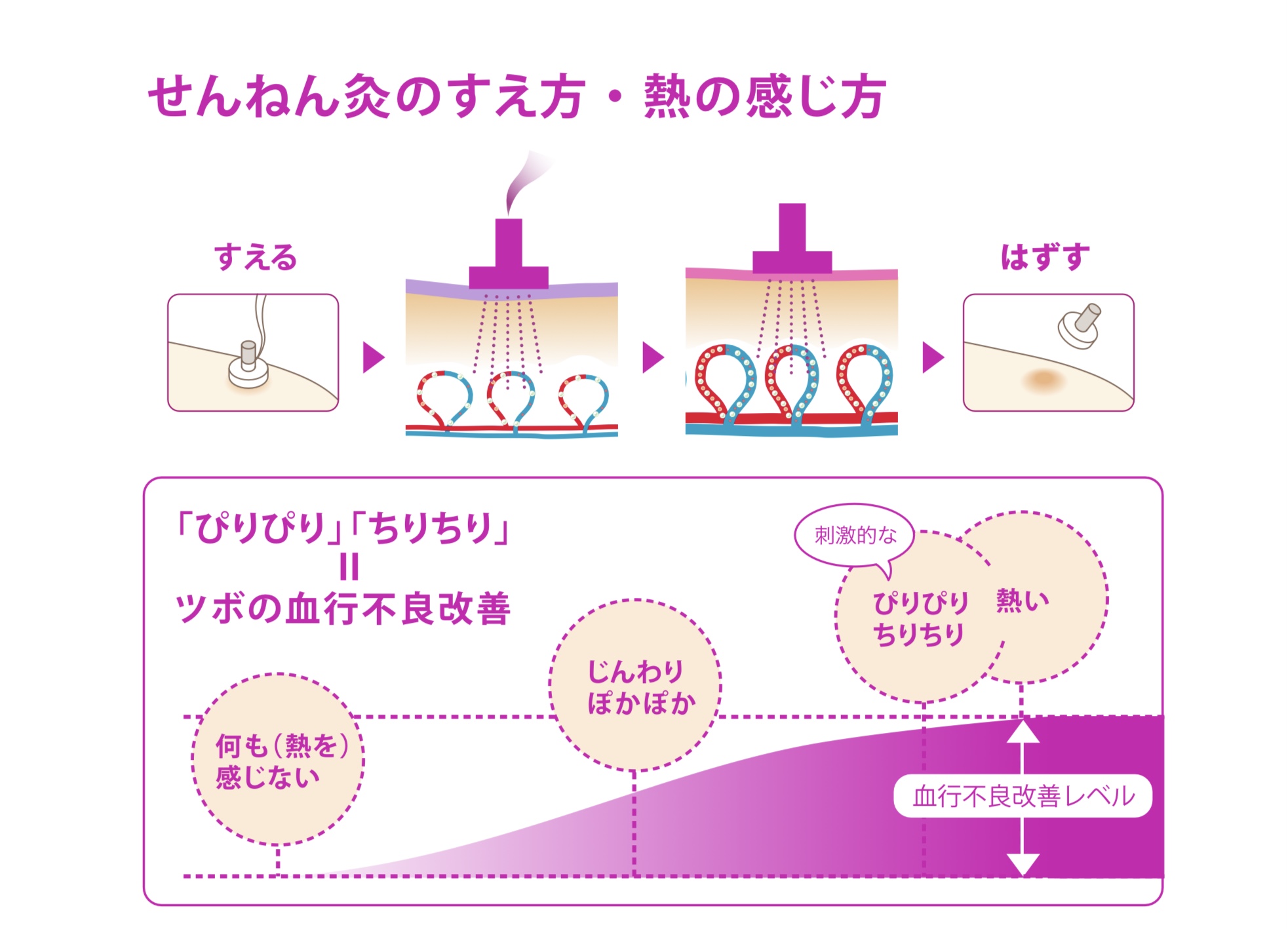 お灸って気持ちいい。自宅で簡単セルフケア - しばがき鍼灸整骨院